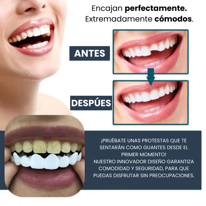 COMPRA 1 Y LLÉVATE 2 - SONRISA RADIANTE® - Dientes blancos en segundos