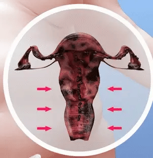 Uro  Probióticos Vaginales - Elimina y previene infecciones, el mal olor y picazón en tu zona íntima en SOLO 1 SEMANA 🚨
